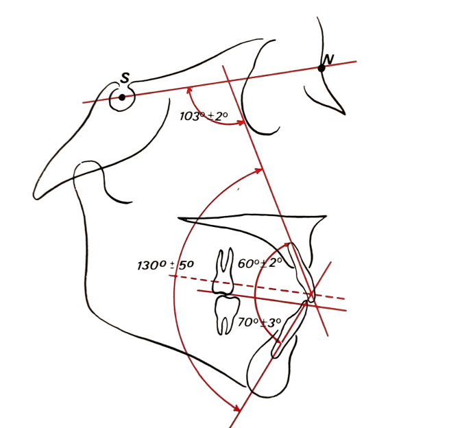 Angolo Incisale